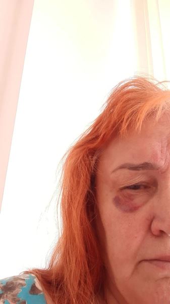 «Он надавил пальцем, и глаз лопнул»: жертвами офтальмолога из Петербурга стали 20 пациентов